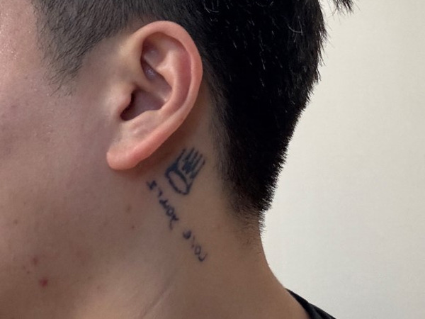 tattoo-removal procedure-IM DONG-HYUN-07.jpg