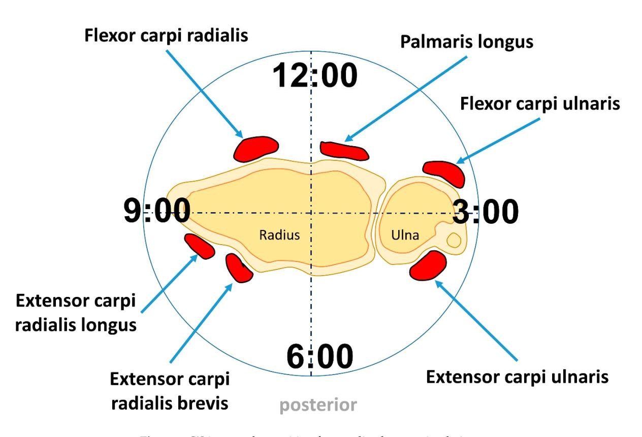 근육의 당기는 위치들.jpg