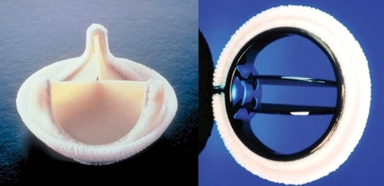 다운로드 (6).jpg