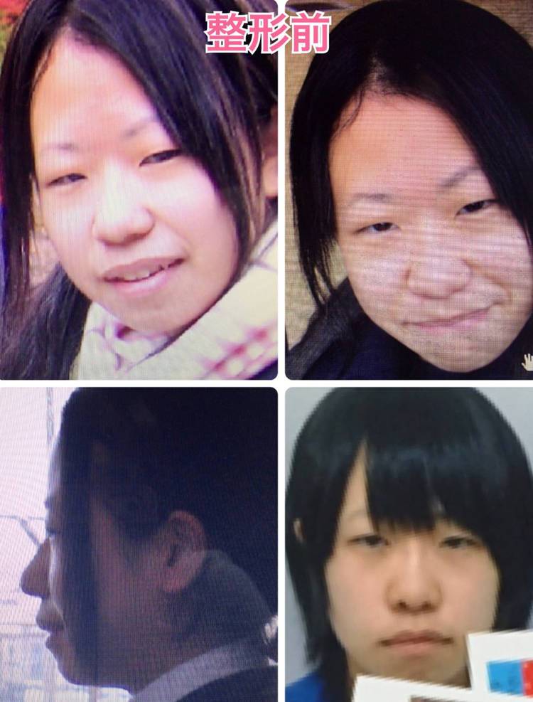 Mikishi-plastic-surgery2.jpg