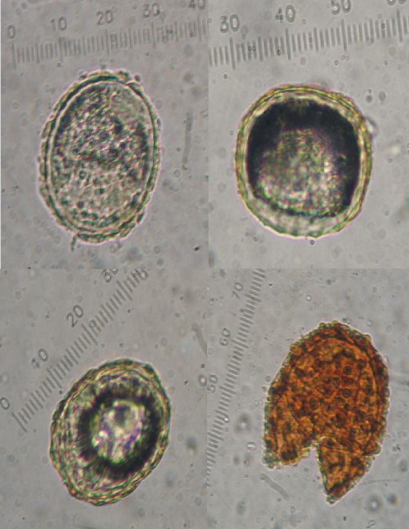 10-4 화장실 유적에서 확인된 회충 알. 국립문화재연구소 제공.jpg