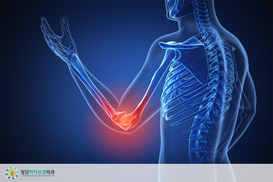 팔꿈치엘보 (2).jpg