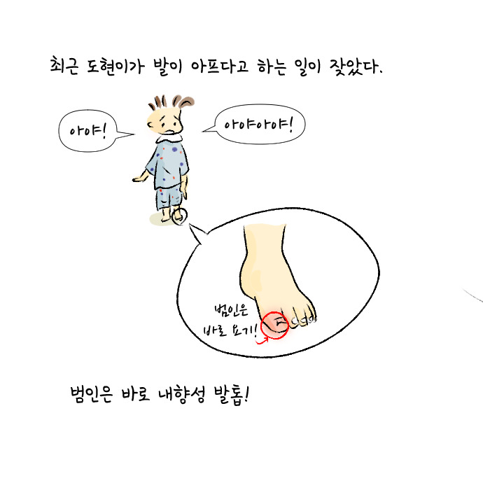 내향성발톱 1.jpg