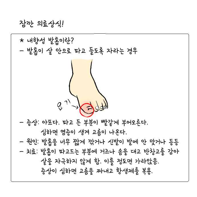 내향성발톱 1-2.jpg