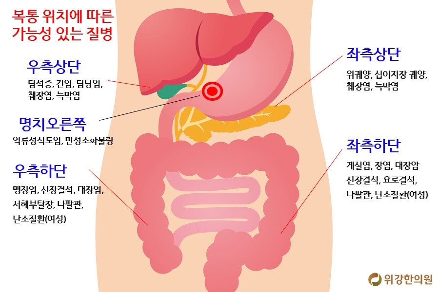 명치1.jpg