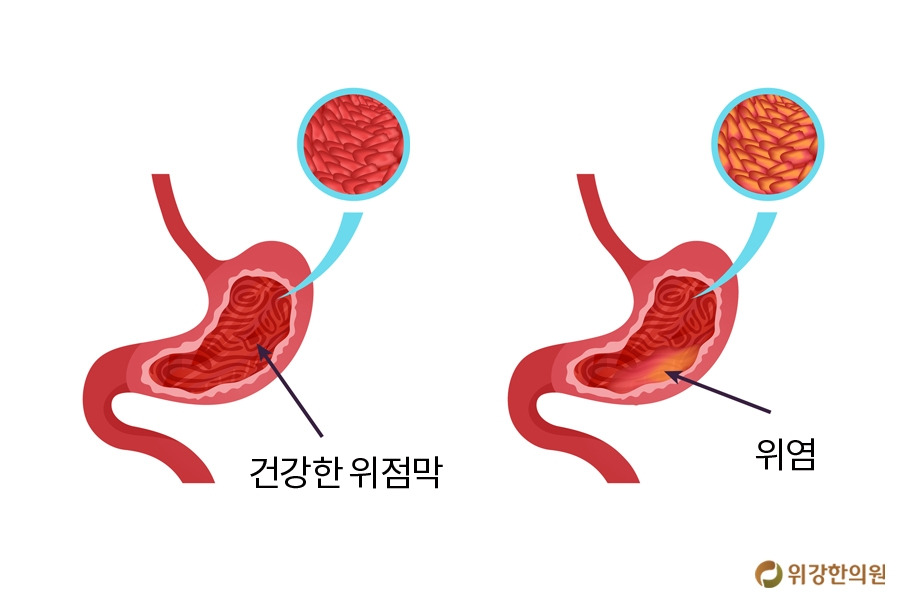 멀미3.jpg
