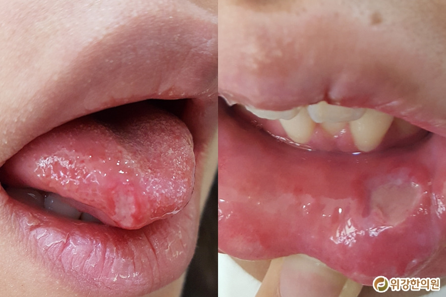 구강6.jpg