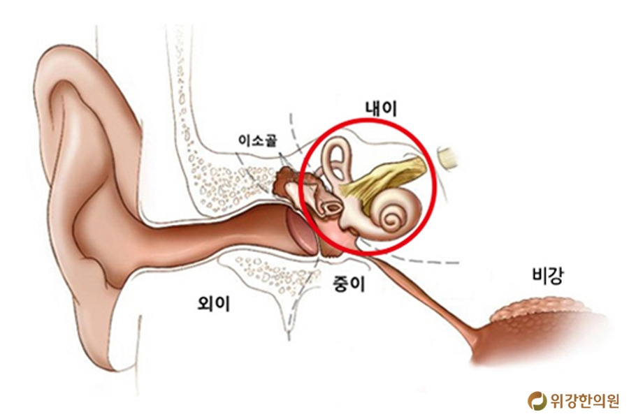 어지럼증원인1.jpg