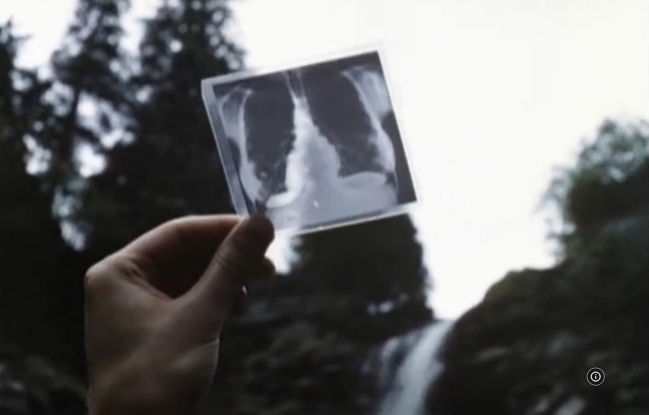 영화 마의산 19.jpg