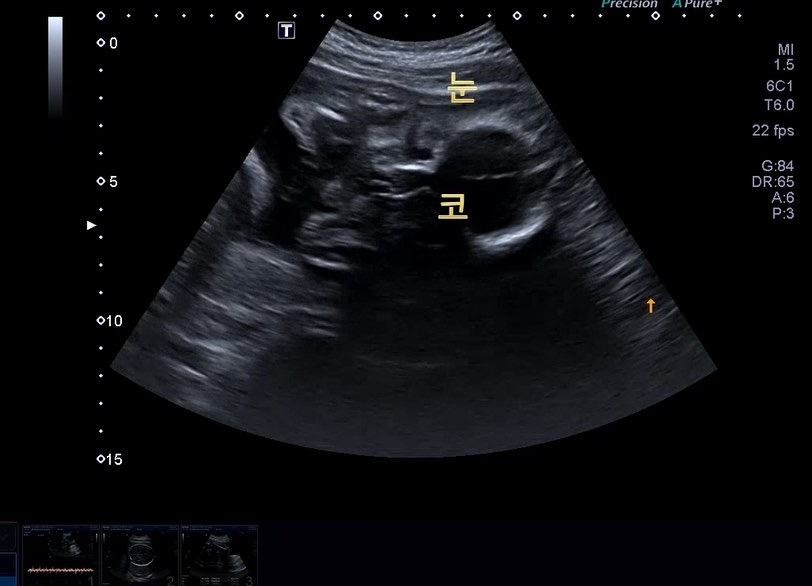 29주 얼굴 눈 코.jpg