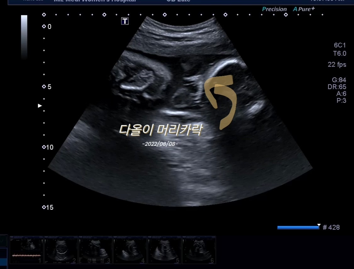 29주 머리카락.jpg