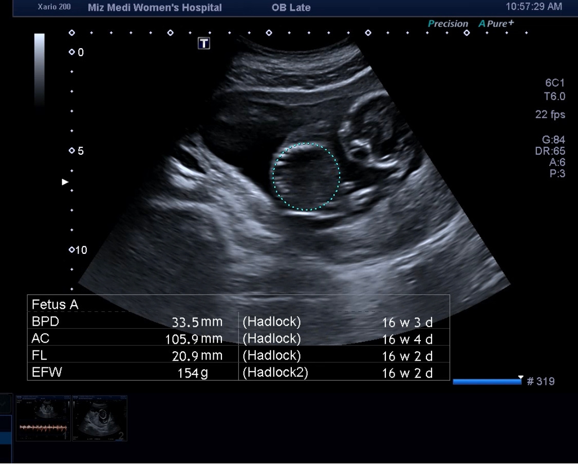16주차 신체 사이즈들.jpg