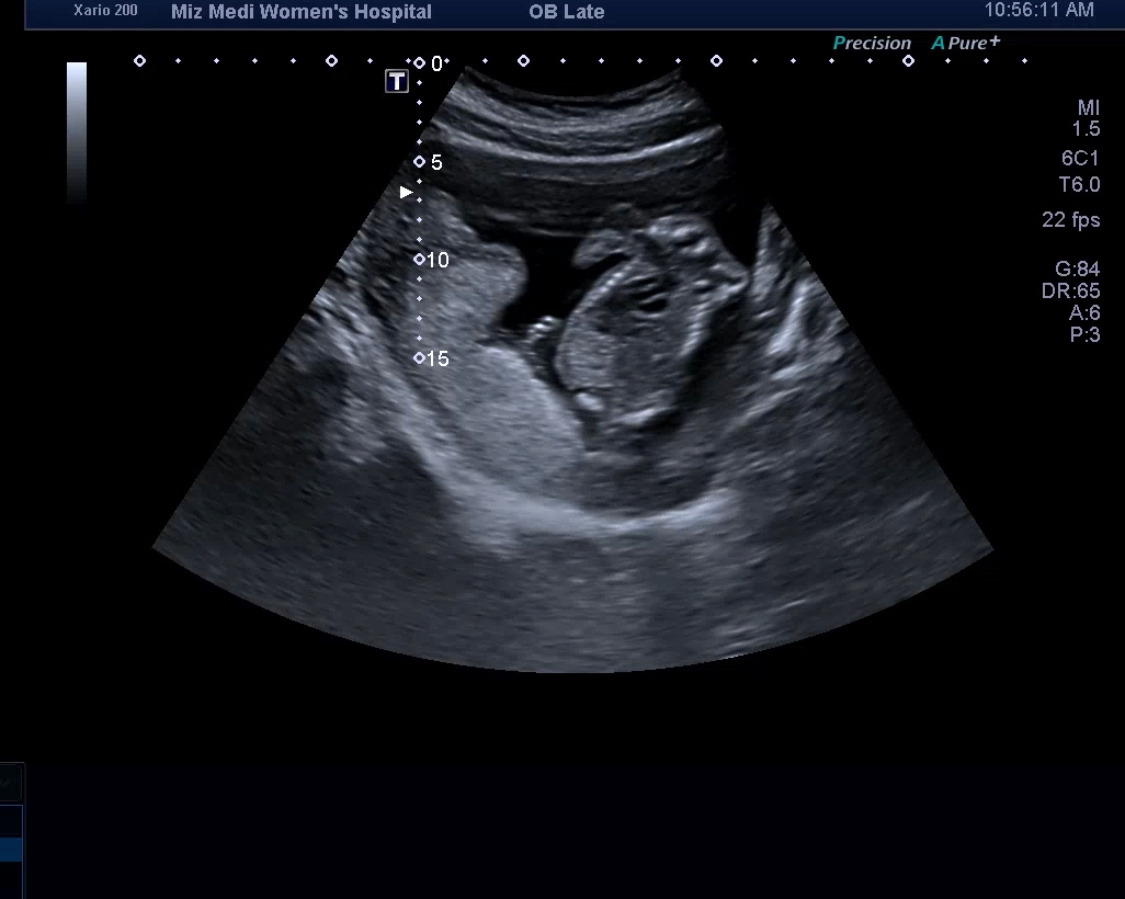 16주차 닭다리컷.jpg