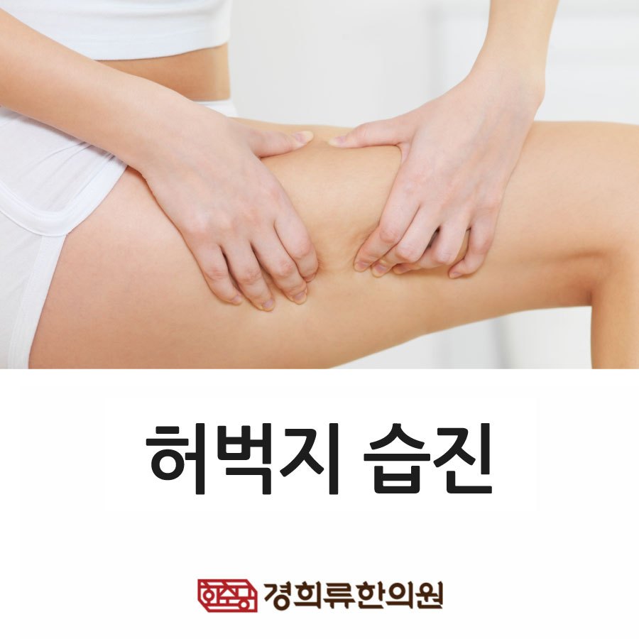 230208_허벅지습진01.jpg
