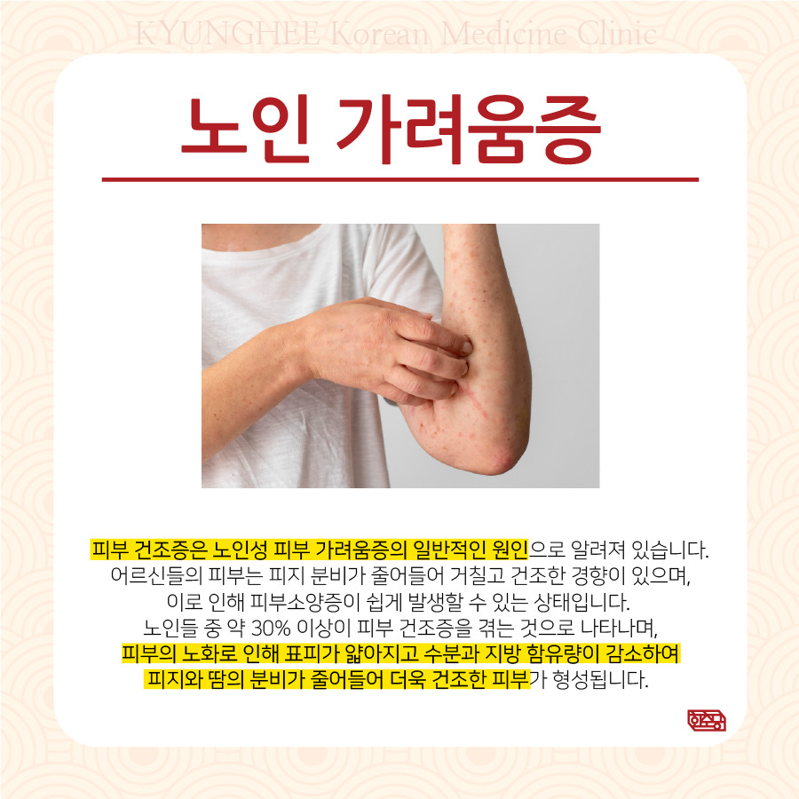 230709_노인성가려움증02.jpg