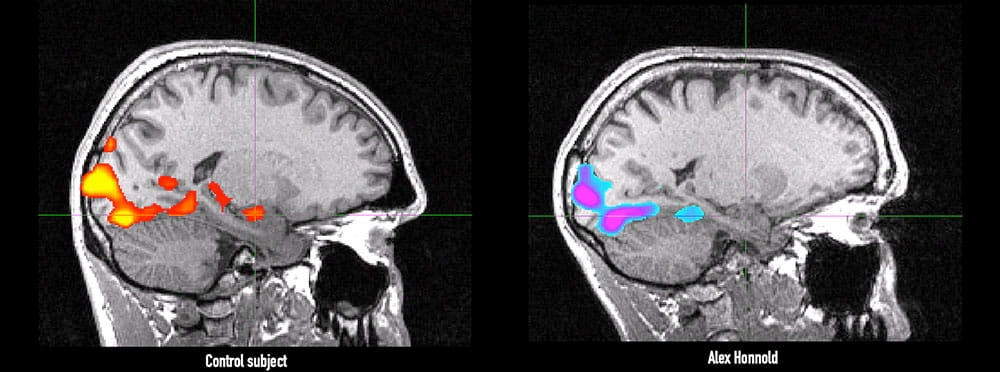 Honnold brain scan.jpg