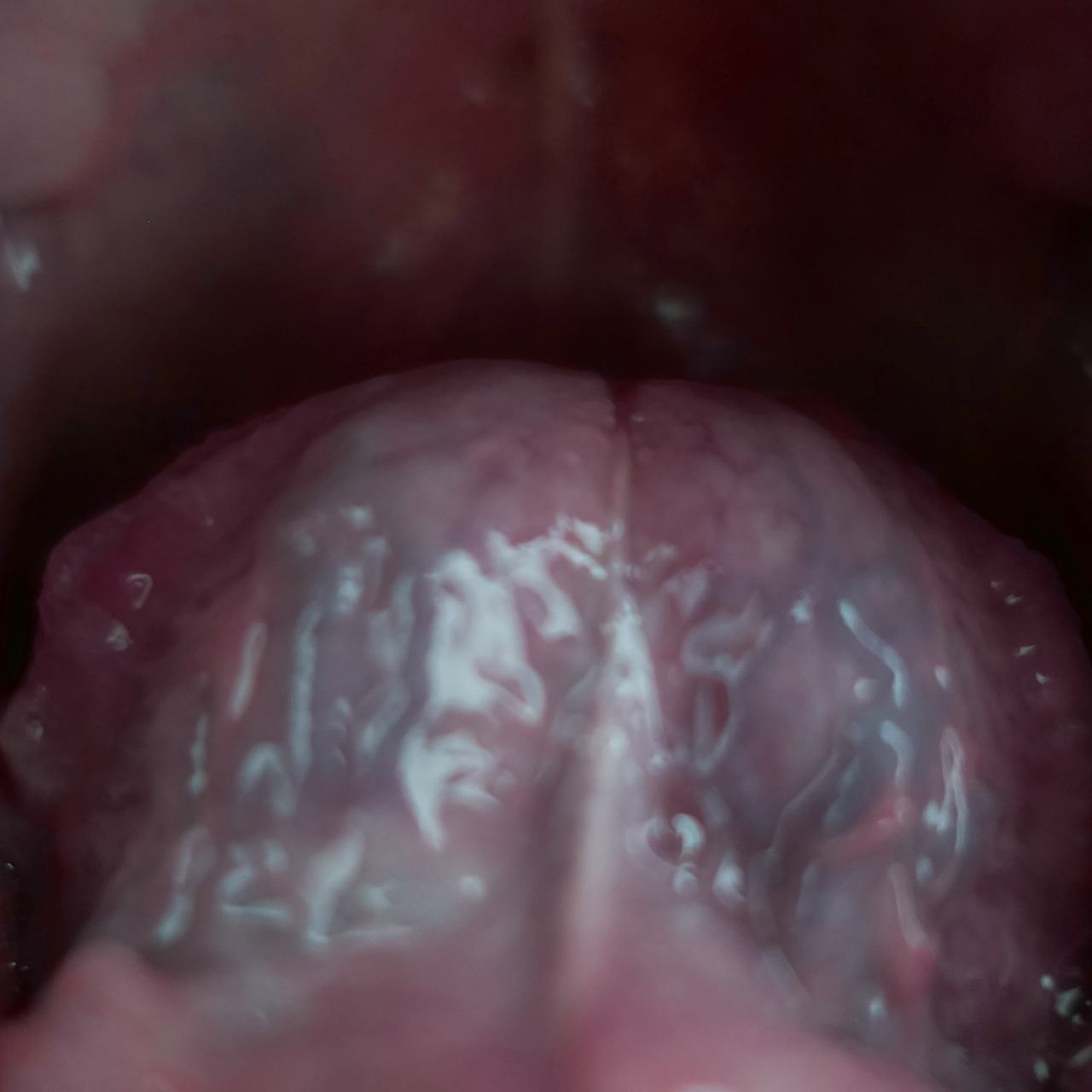 내 우울의 계보 03.jpg