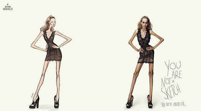 [2-2]거식증 모델.jpg