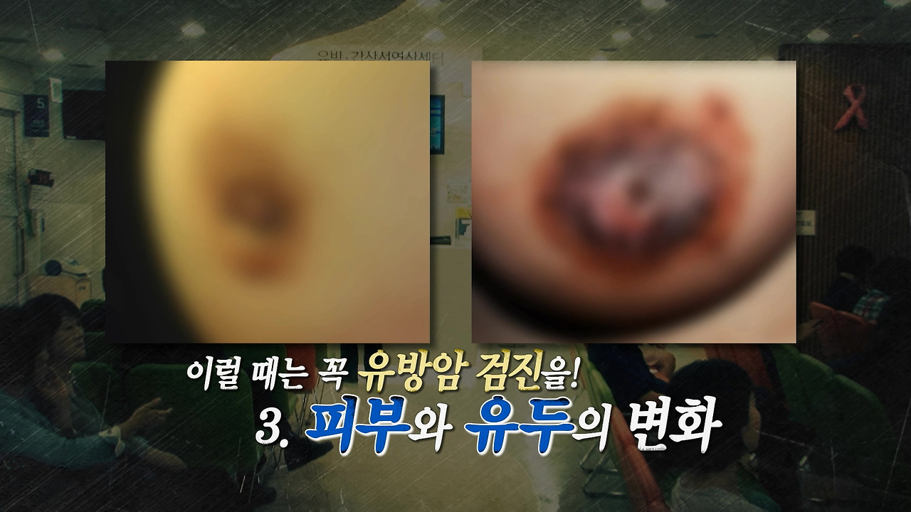 유방암 의심단계3.jpg