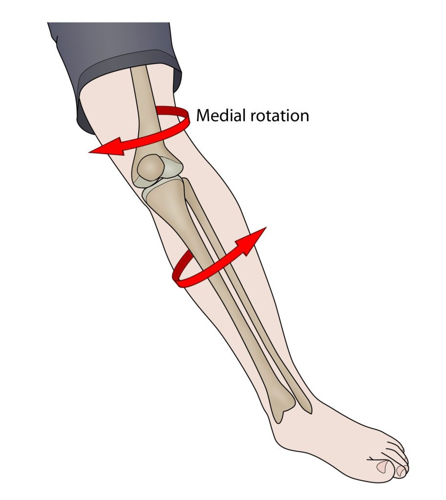 ACL-injury-913x1024.jpg