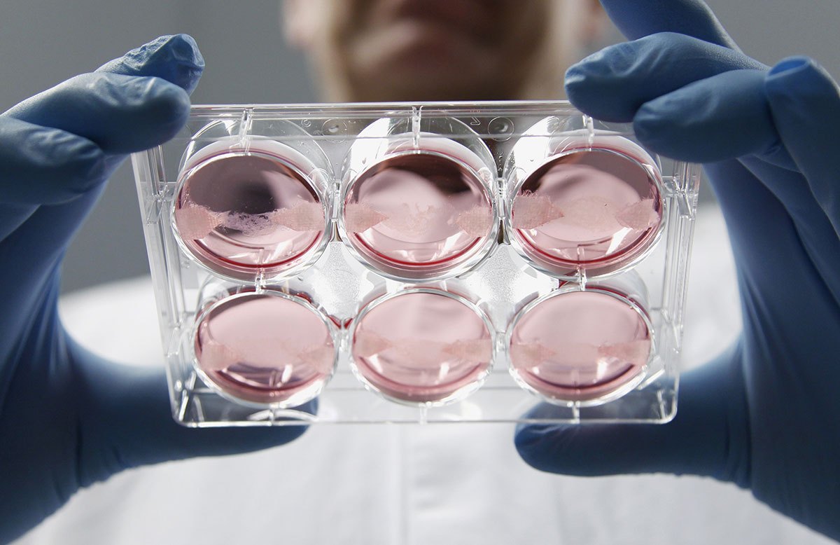 Meat-growing-in-petri-dish-fe8acfe.jpg
