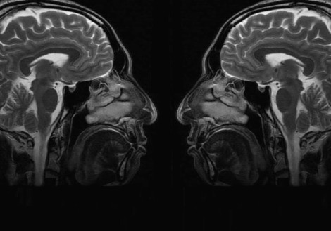 뇌 앞쪽 뒷쪽.jpg