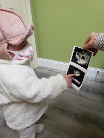 초음파 리아사진.jpg