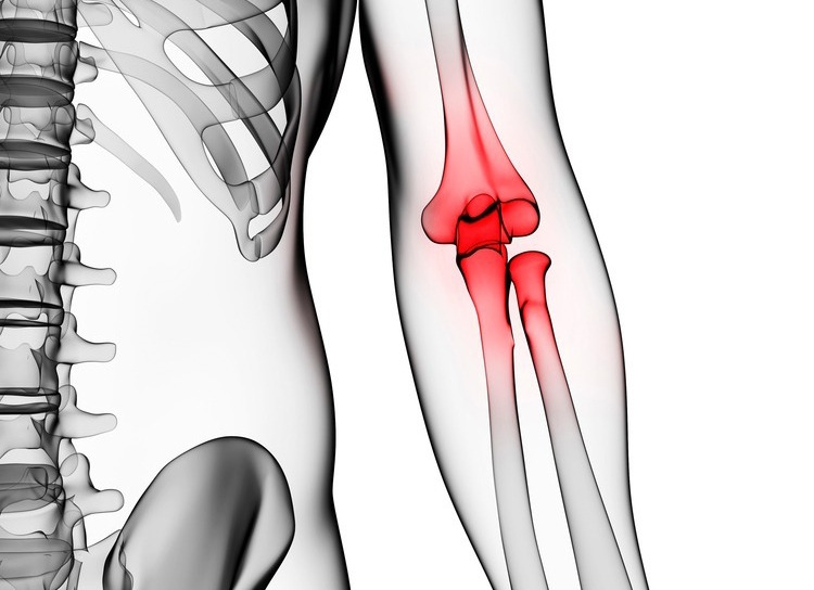 CK_pc004052108_l 사본.jpg