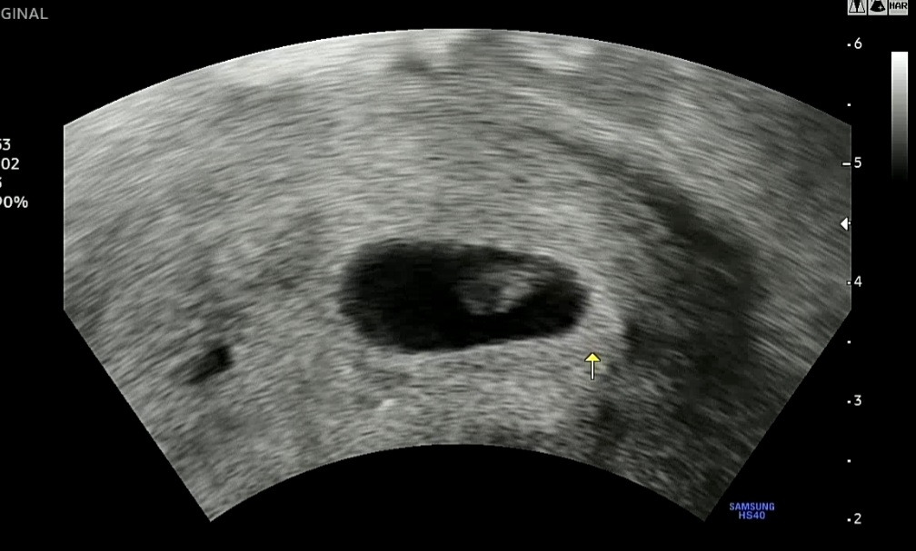 Screenshot_20220905-164227_Gallery (1).jpg