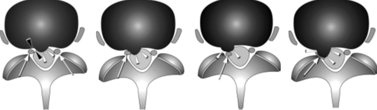 디스크 병기.jpg