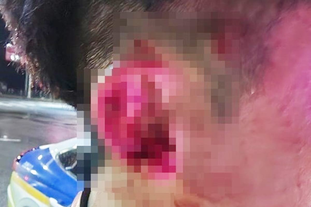 폭행 당한 대리운전 기사 사진 출처 = '뉴스1'.jpg