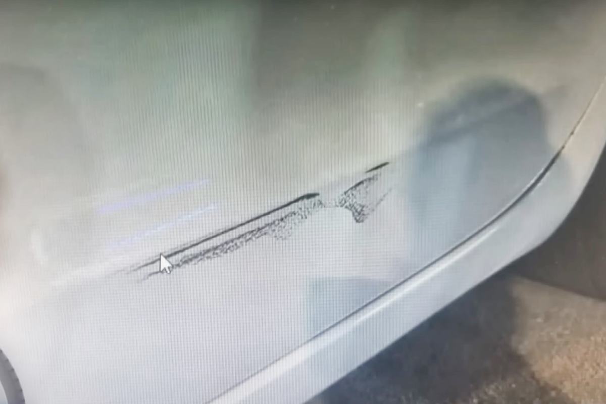 오토바이에 긁힌 사고임에도 한방병원에 입원한 사례 사진 출처 = Youtube '맨인블박'.jpg