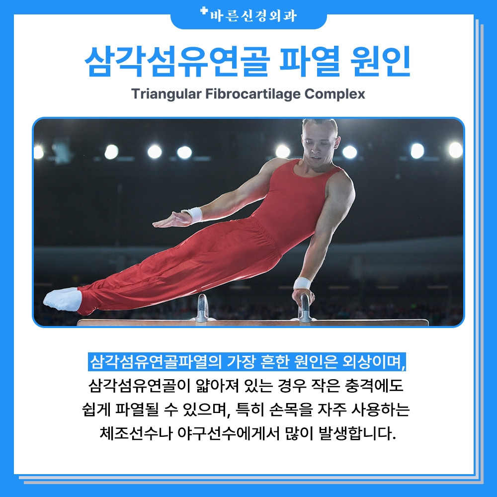 삼각섬유연골파열_원인.jpg