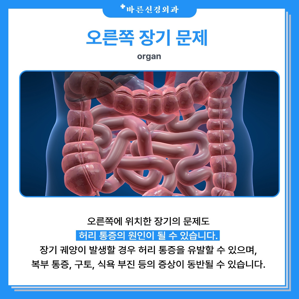장기.jpg