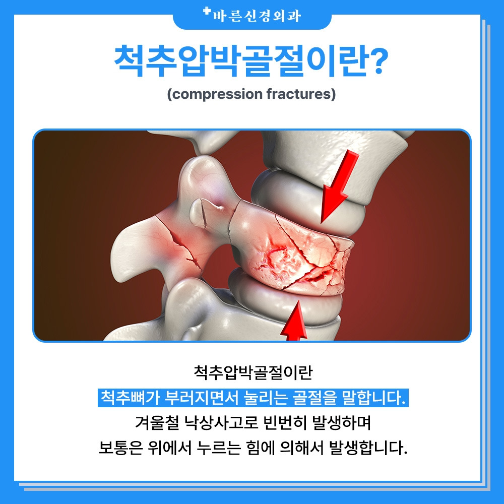 척추압박골절이란.jpg
