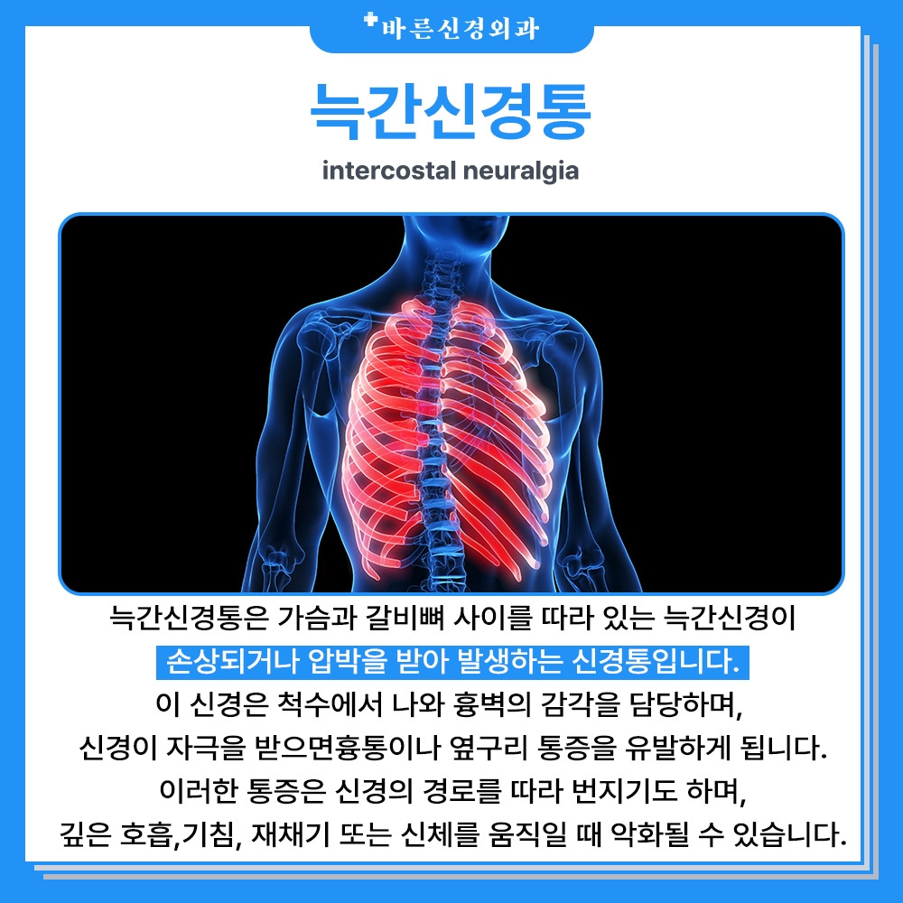 늑간신경통 (1).jpg