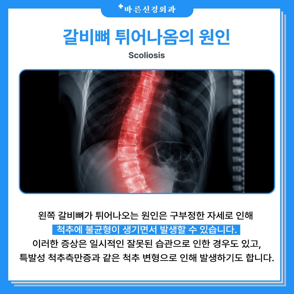 갈비비비 (1).jpg