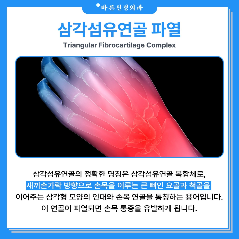 삼각섬유연골파열이란.jpg
