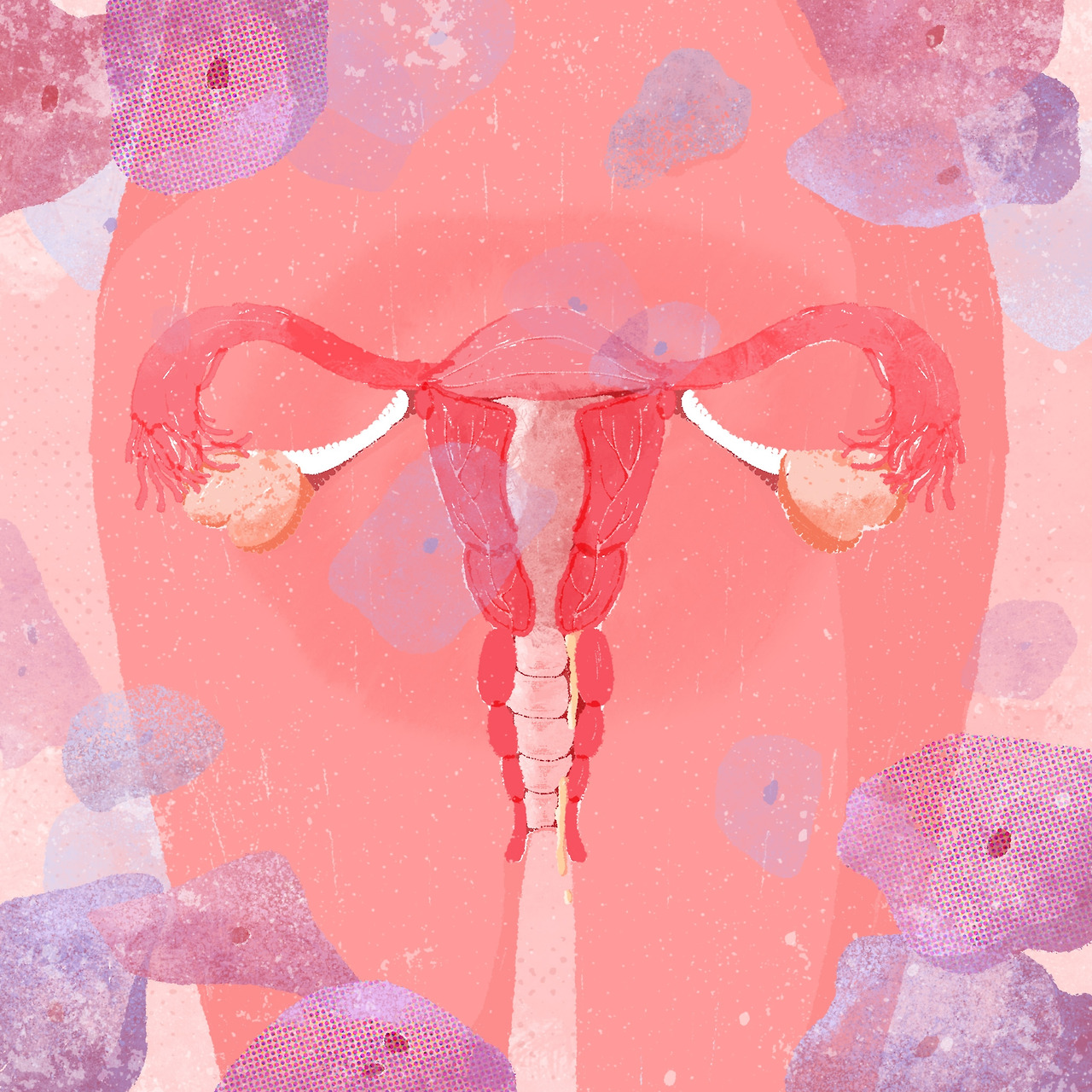 210507_SW_세균성 질염을 유발하는 가드넬라균_김영은.jpg