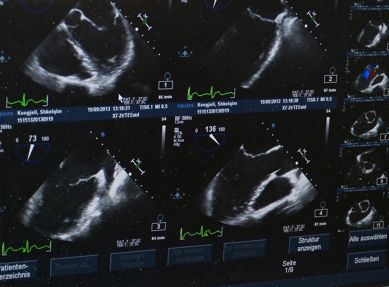 ultrasound-g373dbad36_1920.jpg