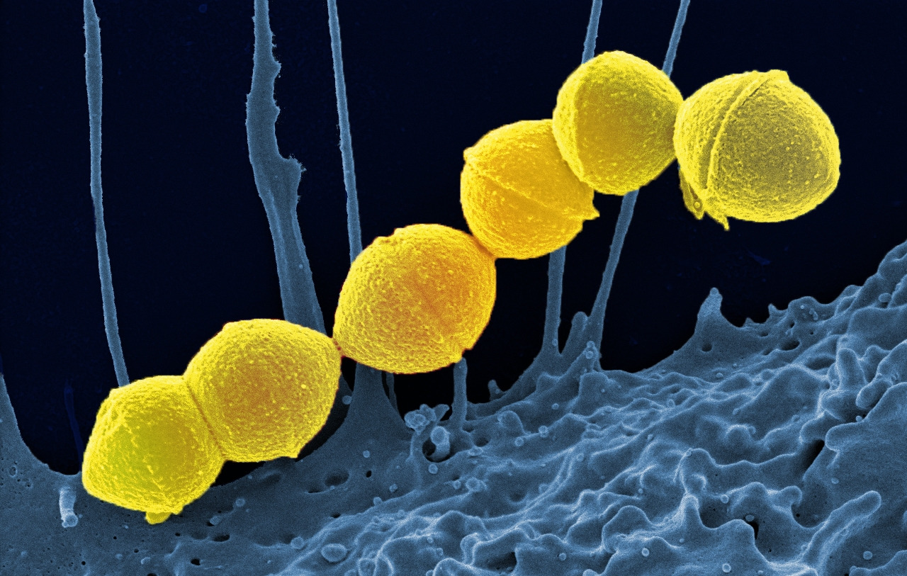 Group A Streptococcus Japan 2024=-6.jpg