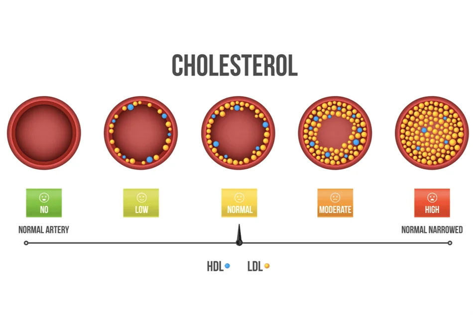 Cholesterol.jpg