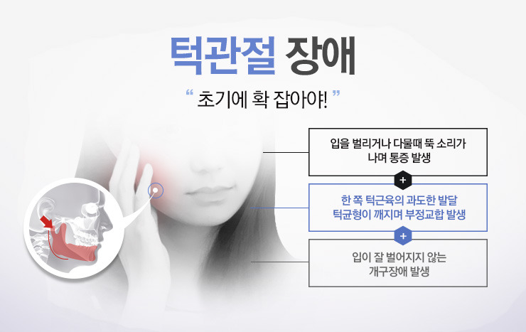 턱관절03.jpg