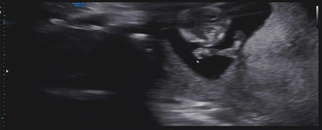 Screenshot_20210906-224757_Video Player.jpg