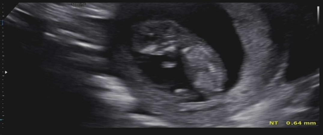 Screenshot_20210906-224604_Video Player.jpg