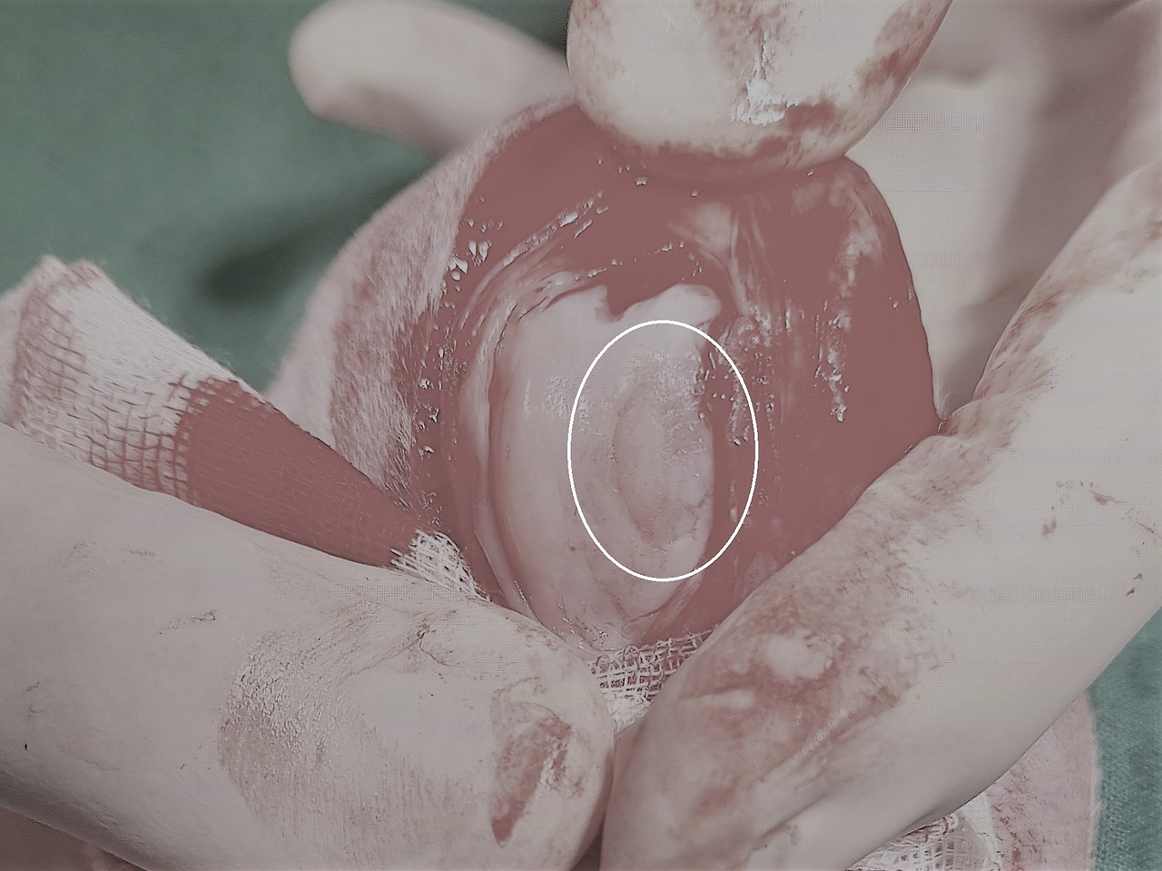 슬개골 탈구-1.jpg