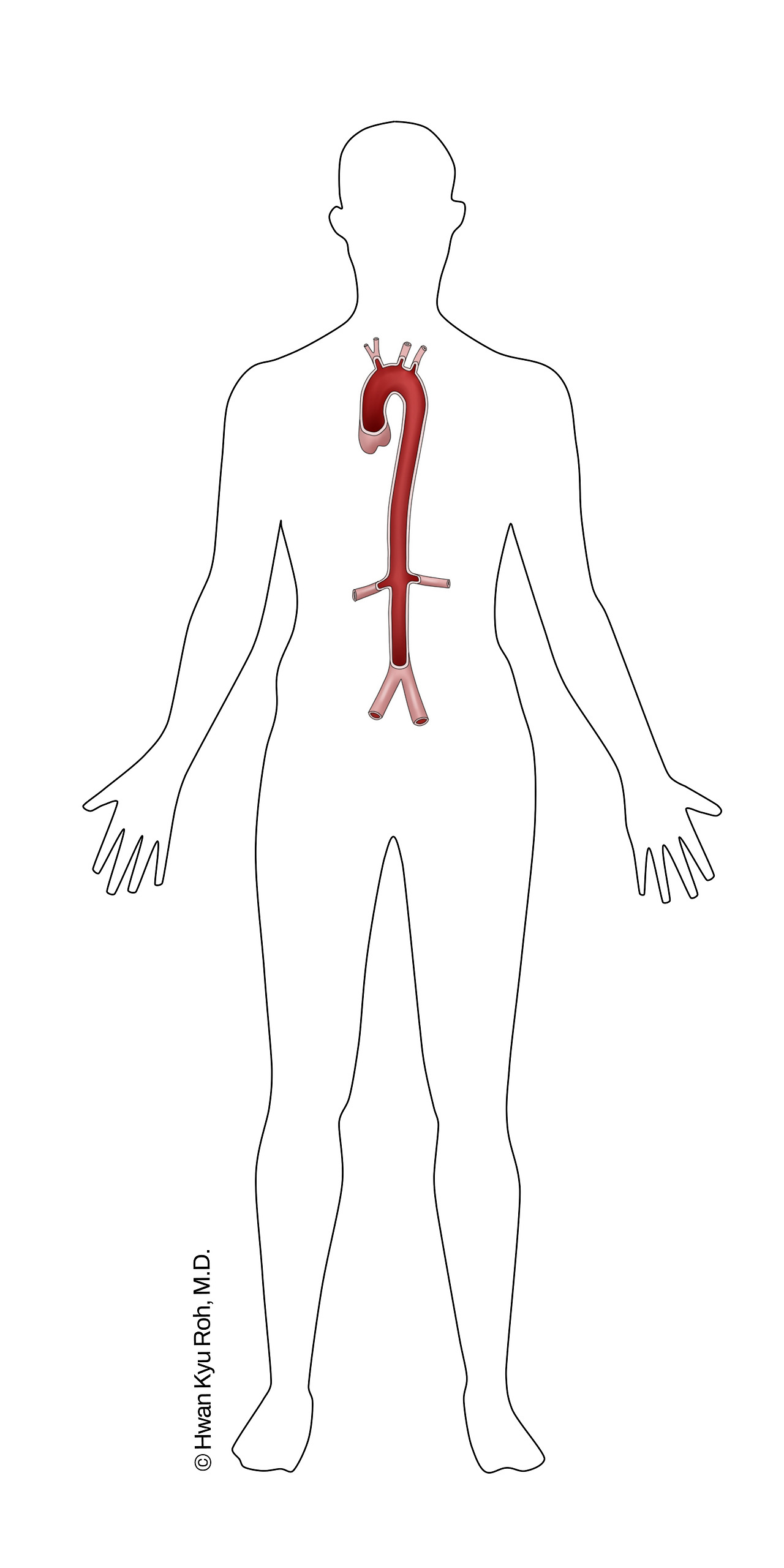 aorta2.jpg