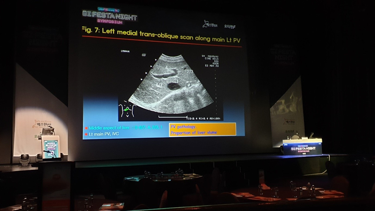 워커힐- 무대조명, PPT 밝기.jpg