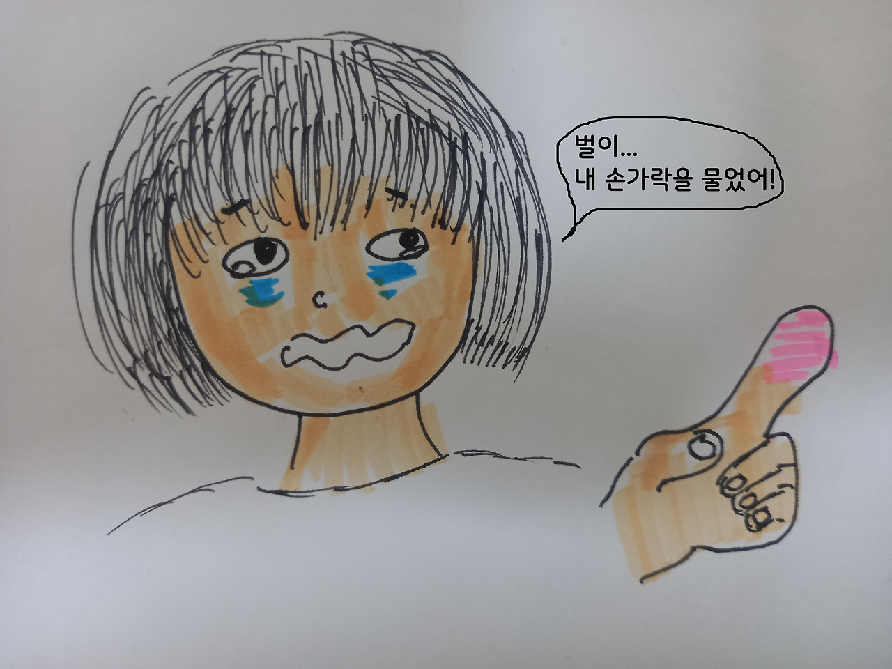 벌에쏘인손가락.jpg