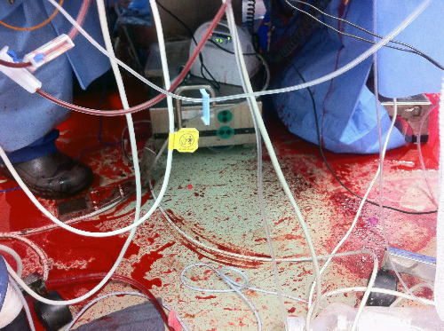 Bloody_OR_Floor.jpg